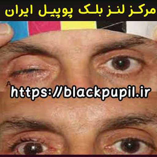 لنز بلک پوپیل2