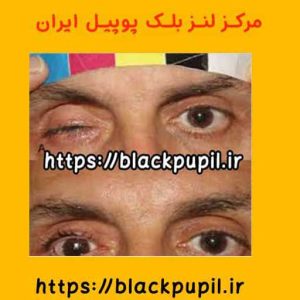 خرید لنز بلک پوپیل